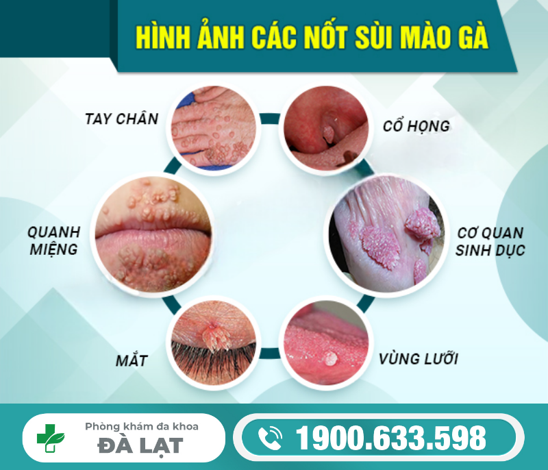 Hình ảnh minh họa